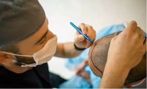 A man getting his hair transplant by a doctor