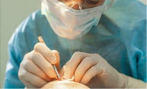 A man getting his hair transplant by a doctor